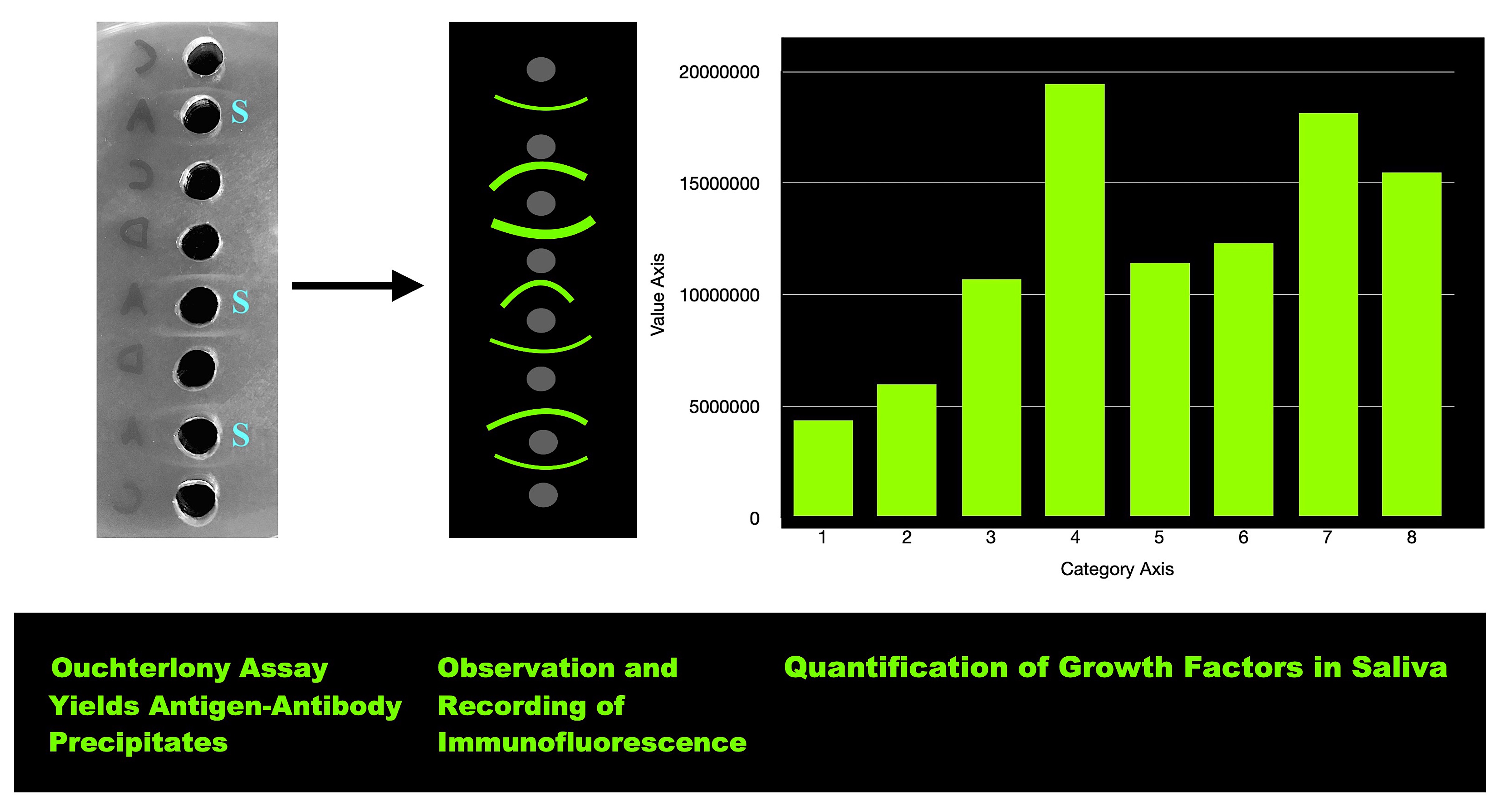 Bengal Bioscience Flow Diagram of Ouchterlony Assay Results using Fluorescein conjugated antibody. The Procedure: Saliva Collection and Preliminary Processing. Saliva is collected by the patient or health care provider/clinical scientist via the Bengal Bioscience home test kit. The passive procedure is used wherein 3-5 ml of passive drool is collected into a test tube for sending to our lab. The saliva kit is received at our lab, and the saliva sample is centrifuged to remove any particulate matter, and made ready for testing. Our Methodology. Samples are then challenged with antibody to various growth factors and cytokines using the Ouchterlony double-diffusion assay, which is an immunochemistry test. Quantification is obtained via microscopic image acquisition using phase contrast and/or immunofluorescence microscopy; followed by software based image analysis for quantification. Comparison of intensities are thereby achieved objectively and without technician variability.